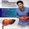 Portal Hypertension Care | Best Gastroenterologist In Bhubaneswar | Dr. Shakti Prasad Chou