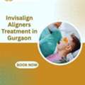 Achieve A Perfect Smile With Invisalign Aligners In Gurgaon