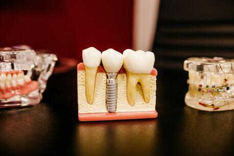 Kolkata, General, Advanced Dental Solutions In Newtown &ndash; AB Dentologic
