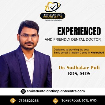 Hyderabad, Dental, Leading Dentist In Secunderabad For Implants & Root Canals
