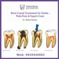 Root Canal Treatment In Noida