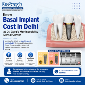 New Delhi, Dental, Know Basal Implant Cost In Delhi At Dr. Garg&rsquo;s Multispeciality Dental Center