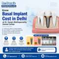 Know Basal Implant Cost In Delhi At Dr. Garg&rsquo;s Multispeciality Dental Center