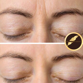 Los Angeles, Health, Aesthetic & Cosmetic Surgeon In Los Angeles | Dr. Saurabh Jain