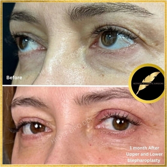 Los Angeles, Health, Aesthetic & Cosmetic Surgeon In Los Angeles | Dr. Saurabh Jain