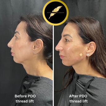 Los Angeles, Health, Aesthetic & Cosmetic Surgeon In Los Angeles | Dr. Saurabh Jain