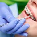 Orthodontic Treatment In Pune | Braces & Invisalign Experts