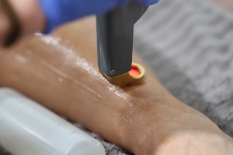 Boston, Medical, Laser Hair Removal & Skin Care In Windham NH