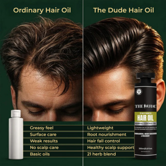 New Delhi, Health & Beauty Items, Best Hair Fall Control Oil For Men For Stronger & Healthier Hair