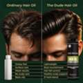 Best Hair Fall Control Oil For Men For Stronger & Healthier Hair