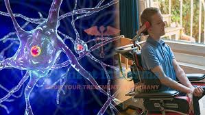 Gurgaon, Businesses For Sale, Motor Neuron Disease Treatment In Gurgaon &ndash; Advanced Physiotherapy & Rehabilitation Care