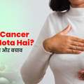 Breast Cancer Kaise Hota Hai? Lakshan, Karan Aur Bachav