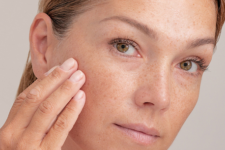 New Delhi, Health, Effective Melasma Treatment In Vasant Kunj For Clearer, Even-Toned Skin