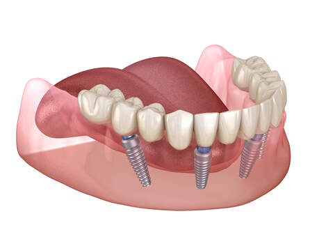 Jaipur, Dental, Best Wisdom Dental Clinic In Jaipur For Complete Oral Care