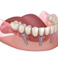 Best Wisdom Dental Clinic In Jaipur For Complete Oral Care