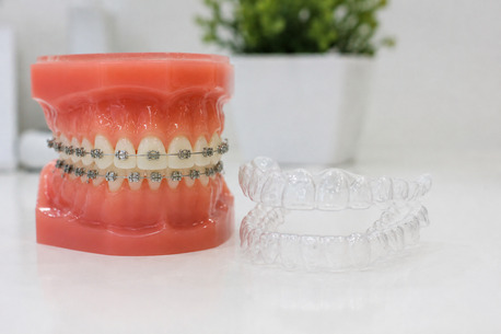 New York, Dental, Modern Orthodontic Care By Orthodontic Experts In Fishers