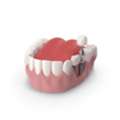 Get Natural Results With Advanced Dental Implant Surgery In Kolkata