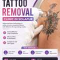 Tattoo Removal Clinic In Solapur | Clear Skin With Expert Care