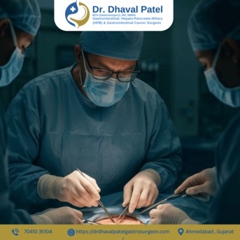 Ahmedabad, Health, Best Laparoscopic Surgery In Ahmedabad For Safe & Faster Recovery