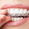 Invisalign Near You For Comfortable And Modern Smile Correction