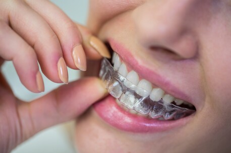 Mumbai, Dental, The Modern Way To Achieve A Confident Smile Through Aligners