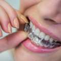 The Modern Way To Achieve A Confident Smile Through Aligners