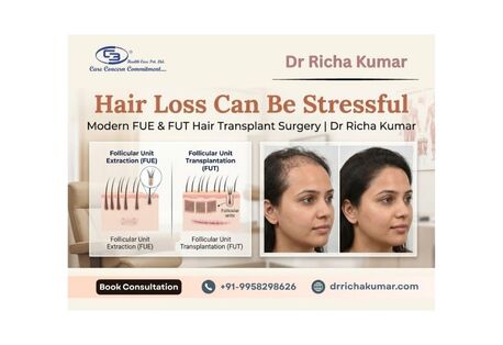 New Delhi, Health, Hair Loss Can Be Stressful &mdash; Modern FUE & FUT Hair Transplant Surgery | Dr Richa Kumar