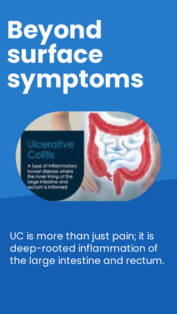 New Delhi, Health, Homeopathy Treatment For Ulcerative Colitis