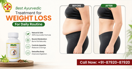 New Delhi, Health, Ayurvedic Weight Loss Treatment For Daily Routine