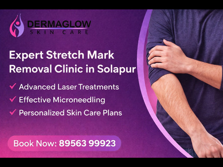 Mumbai, Medical, Stretch Mark Reduction Treatment In Solapur | Healthy, Clear & Confident Skin