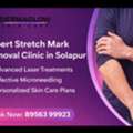 Stretch Mark Reduction Treatment In Solapur | Healthy, Clear & Confident Skin