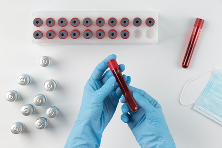 Istanbul, Health, Hemogram Testi Ile Erken Kontrol