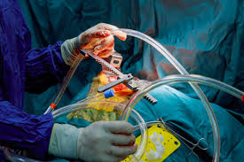 Gurgaon, Health, Top Cardiac Surgeon In India | Expert Heart Care With Mycure Pathway