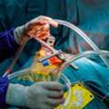 Top Cardiac Surgeon In India | Expert Heart Care With Mycure Pathway