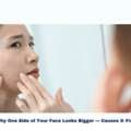 Facial Imbalance And Modern Approaches To Understanding Asymmetry