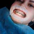 Whitton Dental Excellence &mdash; Implants, Whitening & More