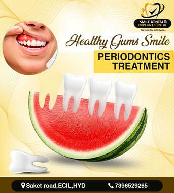 Hyderabad, Dental, Healthy Gums, Healthy Smile: Comprehensive Periodontics Treatment In Secunderabad