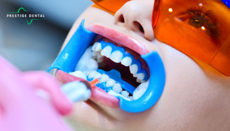 Dallas, Health, Teeth Whitening Fort Worth