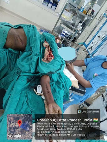 Mumbai, Health, Best Surgical Treatment For Failed Hand Operation Case Near You