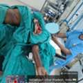 Best Surgical Treatment For Failed Hand Operation Case Near You