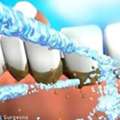 It's Time To Expand Your Dental Scaling And Polishing Options