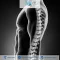 Effective Spinal Fusion Surgery For Long-Term Relief In Ahmedabad By Dr. Rohit Thaker