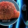 Prostate Treatment In India