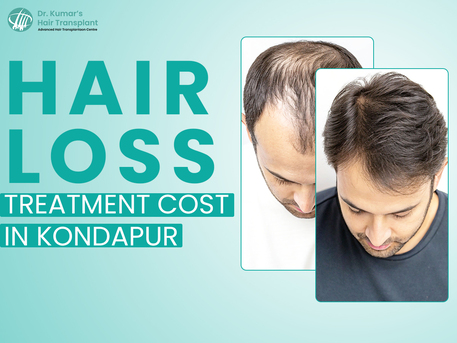 Hyderabad, Health, Dr Kumar Clinic: Transparent Hair Loss Treatment Cost In Kondapur