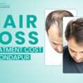 Dr Kumar Clinic: Transparent Hair Loss Treatment Cost In Kondapur