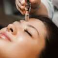 Professional Microneedling Treatment For Face In Islington London