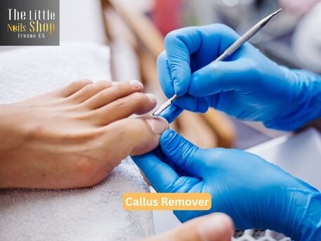 New York, Beautician, How Can I Choose The Right Callus Remover For My Feet?