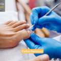How Can I Choose The Right Callus Remover For My Feet?
