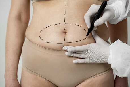 Cape Town, Health, Enhance Your Confidence With Rhinoplasty In South Africa