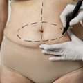 Enhance Your Confidence With Rhinoplasty In South Africa